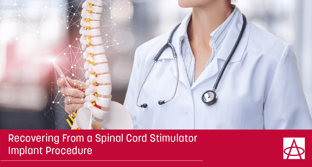 Recovering From a Spinal Cord Stimulator Implant Procedure